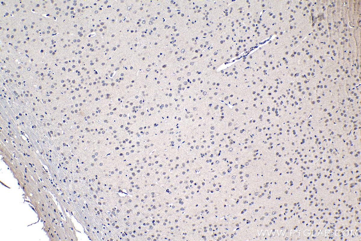 Immunohistochemistry (IHC) staining of rat brain tissue using NUP85 Polyclonal antibody (15027-1-AP)