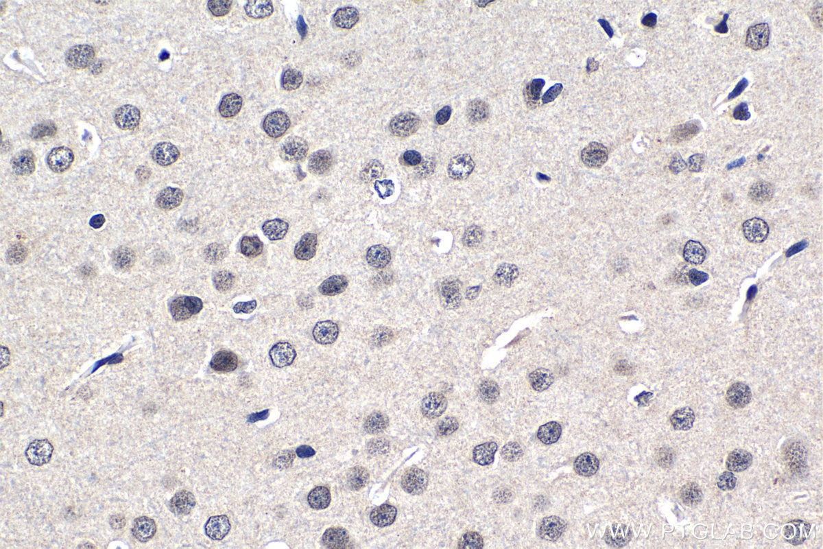Immunohistochemistry (IHC) staining of rat brain tissue using NUP85 Polyclonal antibody (15027-1-AP)