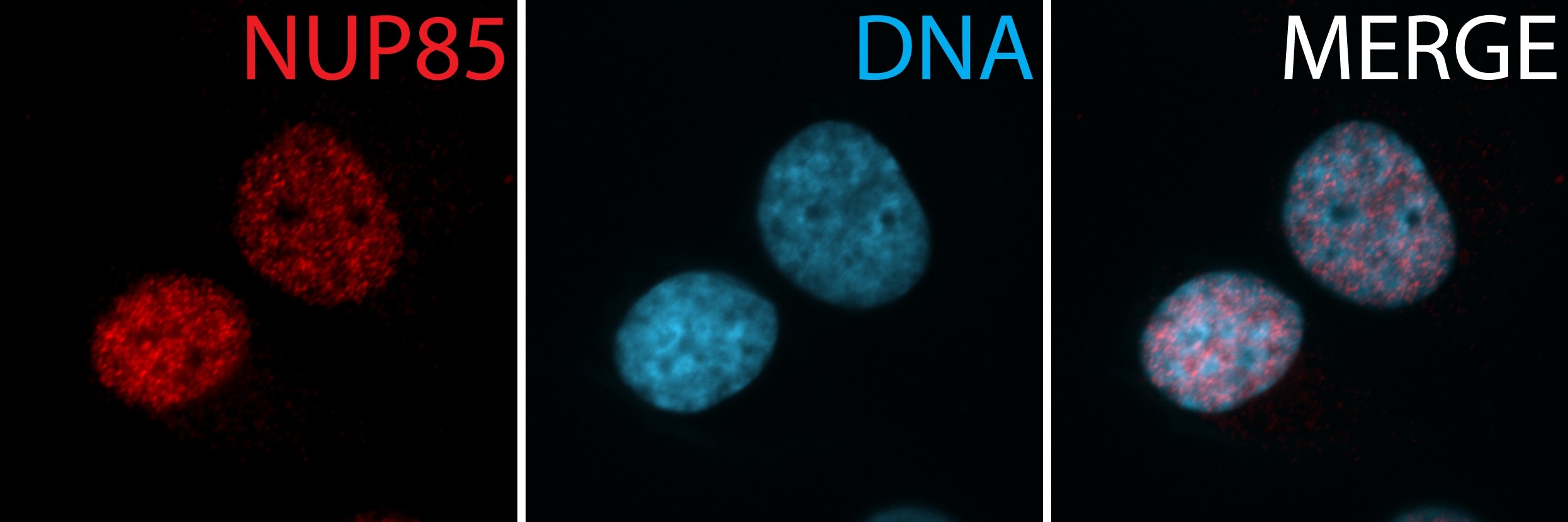 IF Staining of hTERT-RPE1 cells using 19370-1-AP