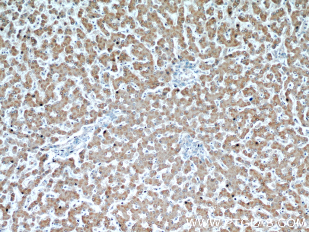 IHC staining of human liver using 19370-1-AP