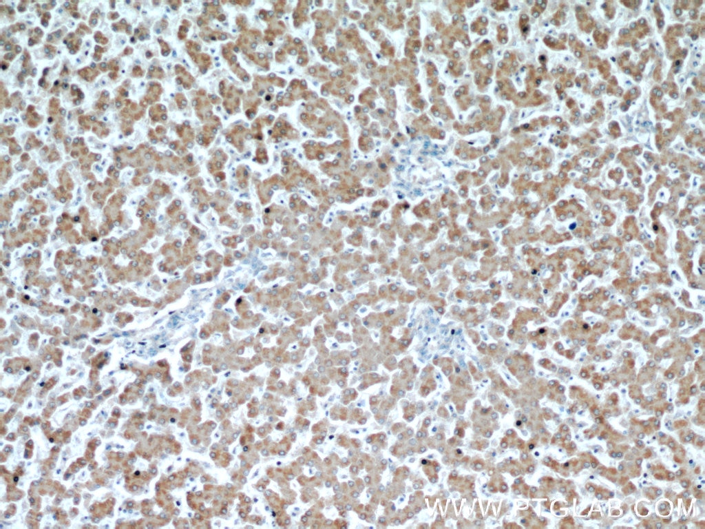 Immunohistochemistry (IHC) staining of human liver tissue using NUP85 Polyclonal antibody (19370-1-AP)