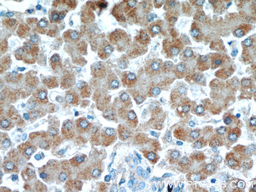 Immunohistochemistry (IHC) staining of human liver tissue using NUP85 Polyclonal antibody (19370-1-AP)