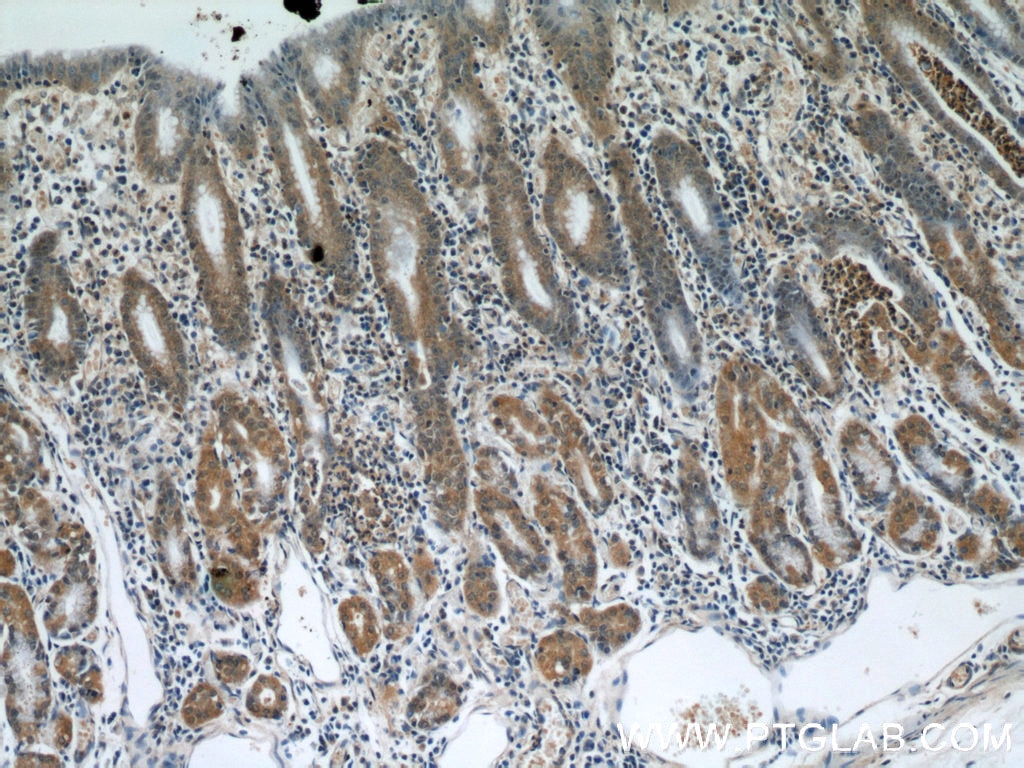 IHC staining of human stomach using 19370-1-AP