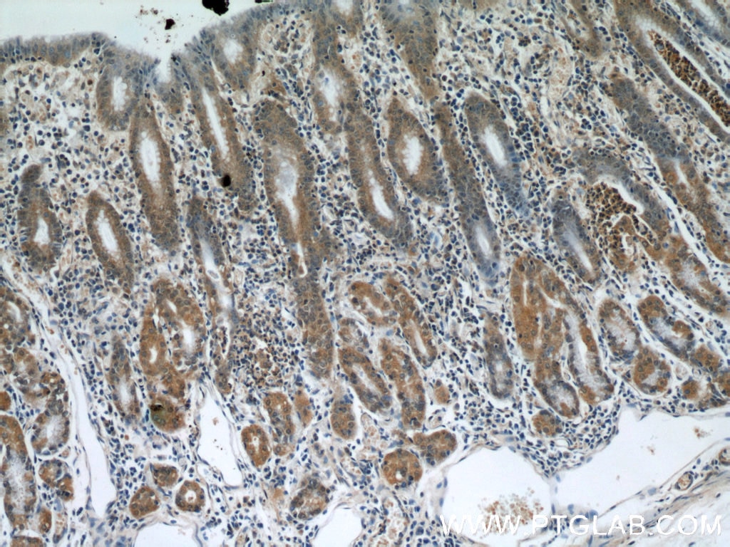 Immunohistochemistry (IHC) staining of human stomach tissue using NUP85 Polyclonal antibody (19370-1-AP)