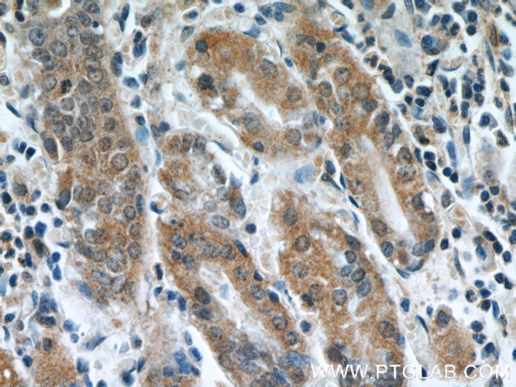 Immunohistochemistry (IHC) staining of human stomach tissue using NUP85 Polyclonal antibody (19370-1-AP)