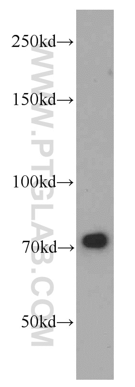 Western Blot (WB) analysis of mouse lung tissue using NUP85 Polyclonal antibody (19370-1-AP)