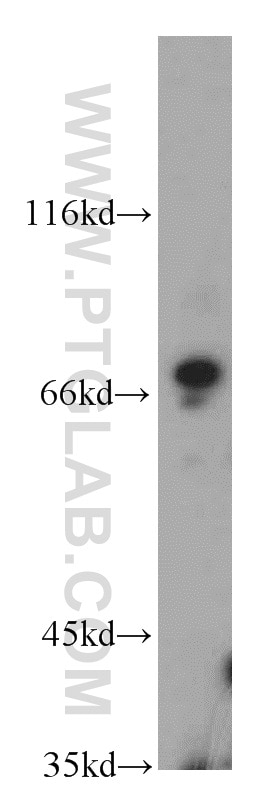 Western Blot (WB) analysis of human brain tissue using NUP85 Polyclonal antibody (19370-1-AP)