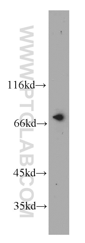 Western Blot (WB) analysis of HeLa cells using NUP85 Polyclonal antibody (19370-1-AP)