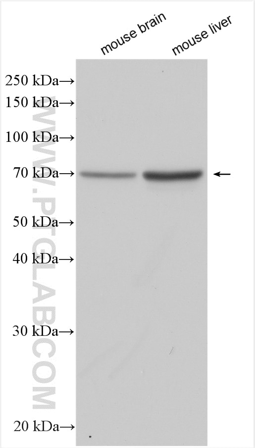 Western Blot (WB) analysis of various lysates using NUP85 Polyclonal antibody (30158-1-AP)