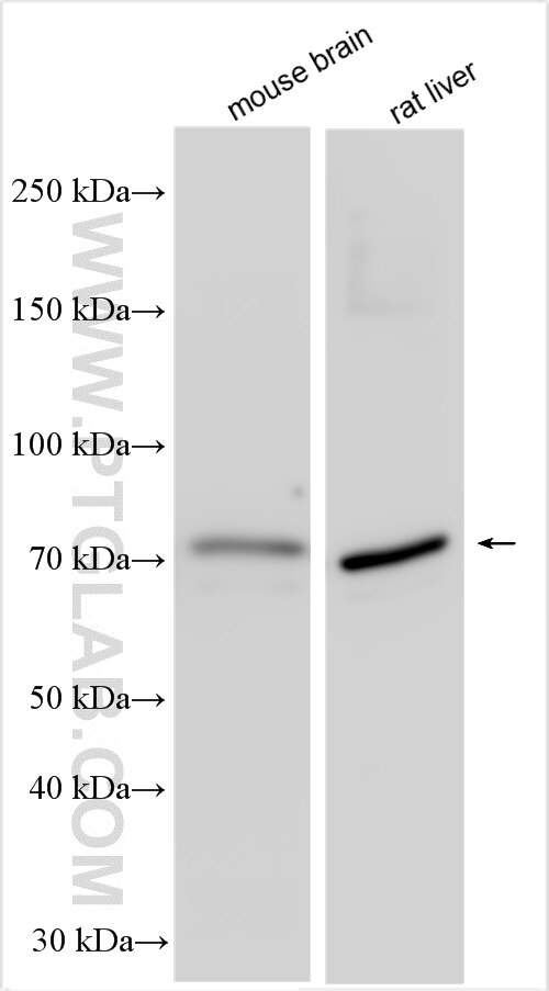 Western Blot (WB) analysis of various lysates using NUP85 Polyclonal antibody (30158-1-AP)
