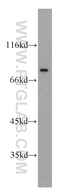 Western Blot (WB) analysis of HeLa cells using NUP88 Polyclonal antibody (55465-1-AP)