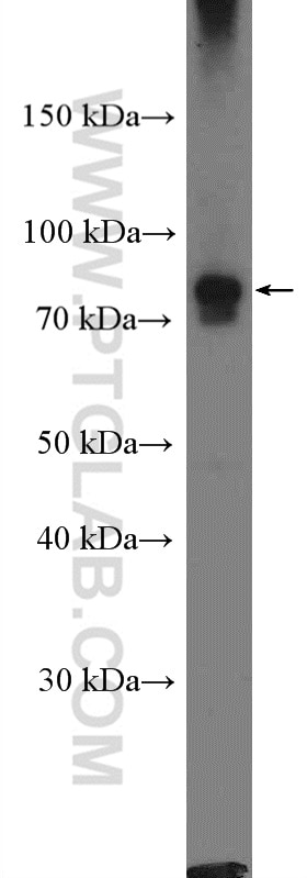 Western Blot (WB) analysis of A431 cells using NUP93 Polyclonal antibody (13077-1-AP)