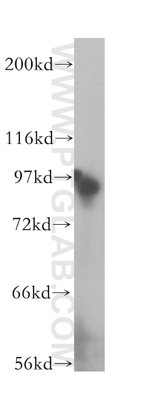 Western Blot (WB) analysis of HEK-293 cells using NUP93 Polyclonal antibody (13077-1-AP)
