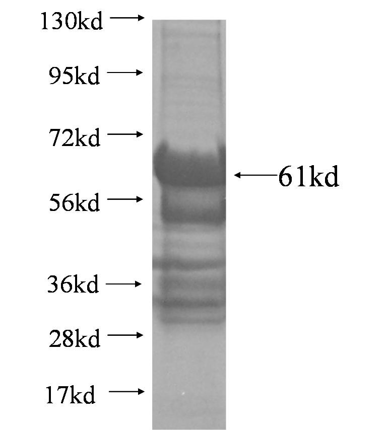 NUP93 fusion protein Ag3735 SDS-PAGE