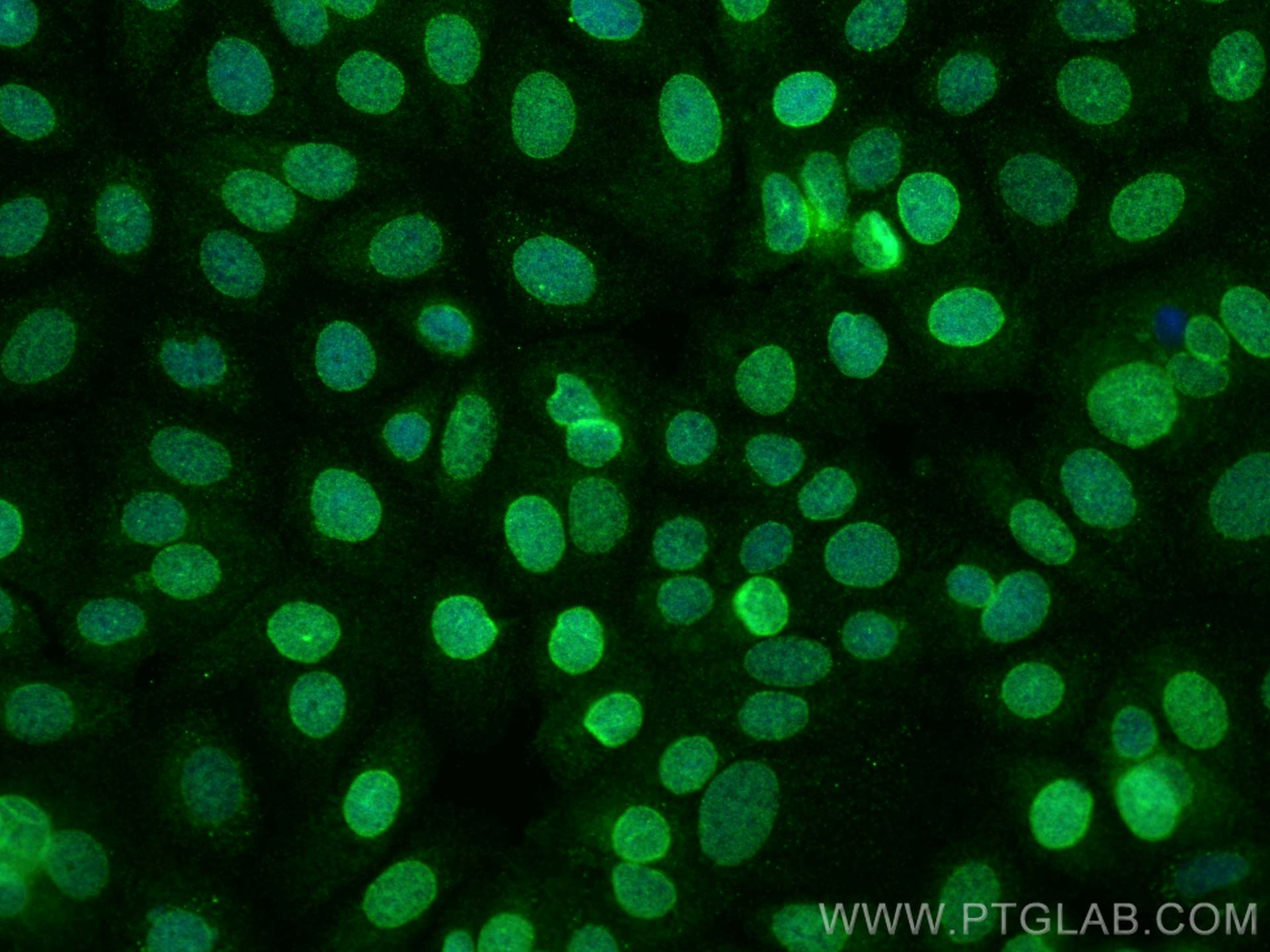 Immunofluorescence (IF) / fluorescent staining of MCF-7 cells using NUP98-NUP96 Polyclonal antibody (12329-1-AP)