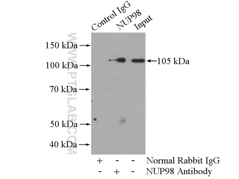 Immunoprecipitation (IP) experiment of COLO 320 cells using NUP98-NUP96 Polyclonal antibody (12329-1-AP)