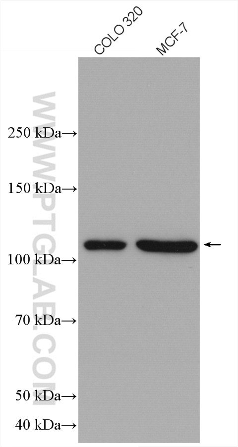 Western Blot (WB) analysis of various lysates using NUP98-NUP96 Polyclonal antibody (12329-1-AP)
