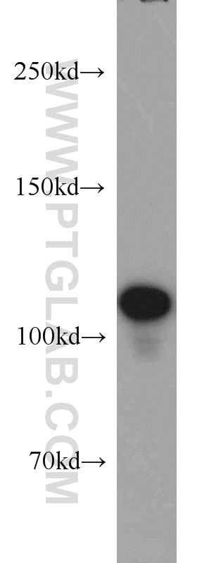 NUP98-NUP96 Polyclonal antibody