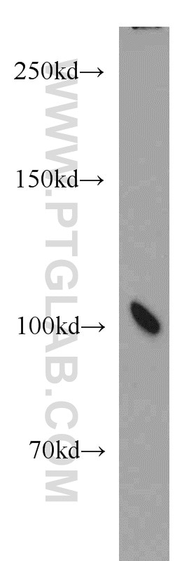 Western Blot (WB) analysis of Jurkat cells using NUP98-NUP96 Polyclonal antibody (12329-1-AP)