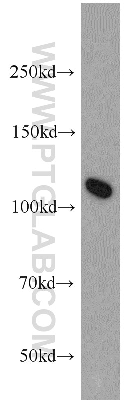 Western Blot (WB) analysis of HeLa cells using NUP98-NUP96 Polyclonal antibody (12329-1-AP)