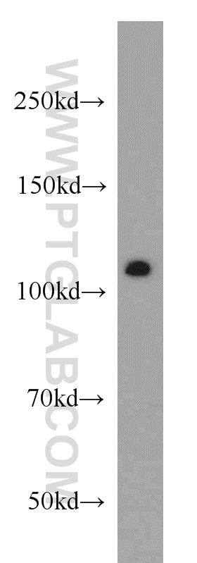 Western Blot (WB) analysis of K-562 cells using NUP98-NUP96 Polyclonal antibody (12329-1-AP)