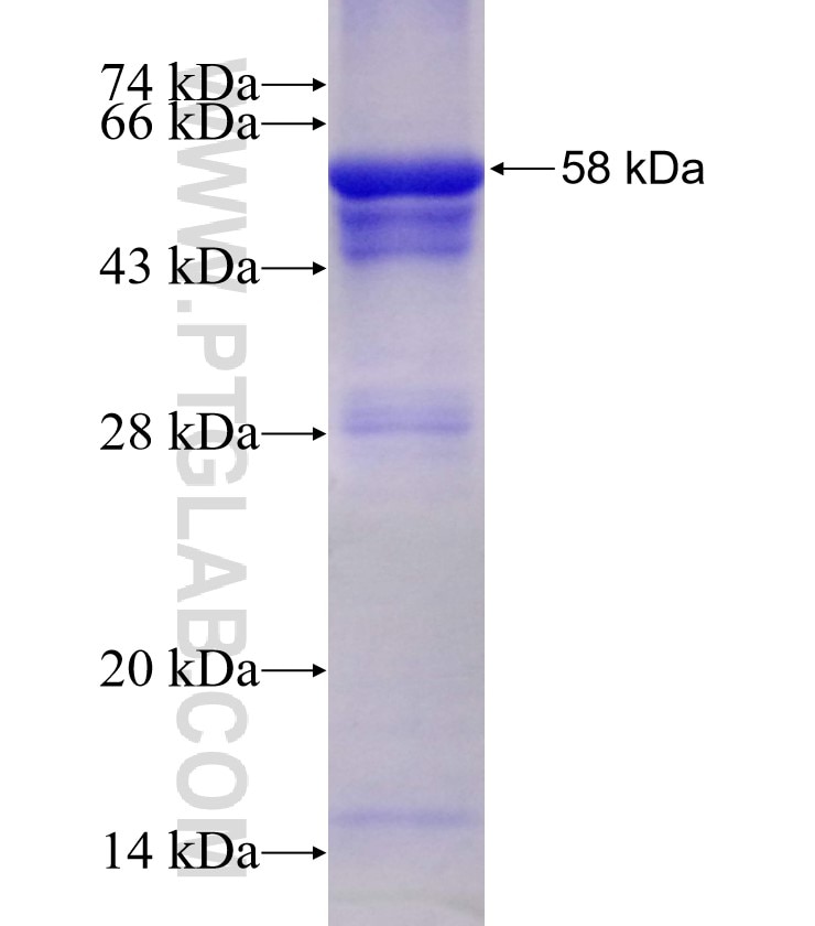 NUP98-NUP96 fusion protein Ag3016 SDS-PAGE