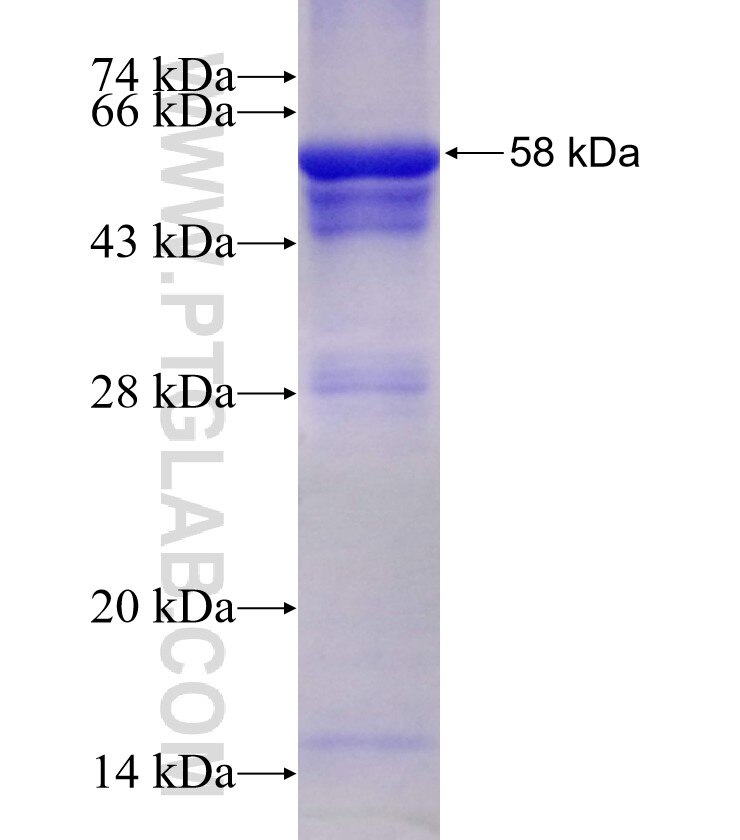 NUP98-NUP96 fusion protein Ag3016 SDS-PAGE