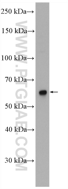 Western Blot (WB) analysis of HepG2 cells using NUPL1 Polyclonal antibody (19907-1-AP)