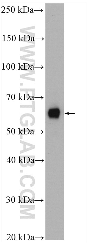 Western Blot (WB) analysis of HeLa cells using NUPL1 Polyclonal antibody (19907-1-AP)