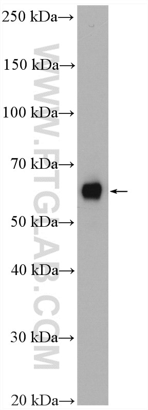 WB analysis of HeLa using 19907-1-AP