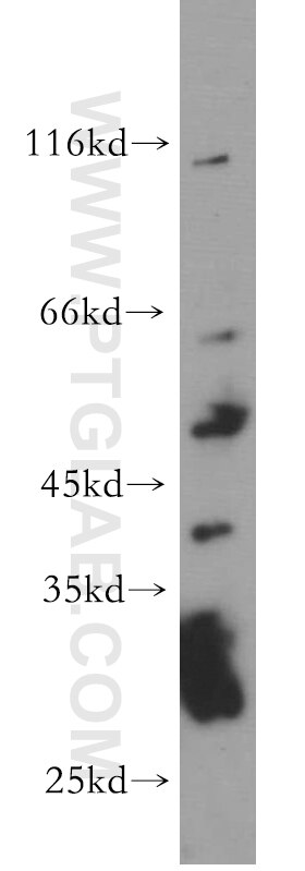 Western Blot (WB) analysis of mouse brain tissue using NUPL1 Polyclonal antibody (19907-1-AP)