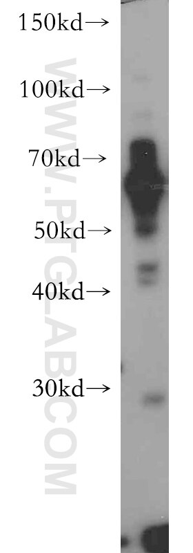 Western Blot (WB) analysis of L02 cells using NUPL1 Polyclonal antibody (19907-1-AP)