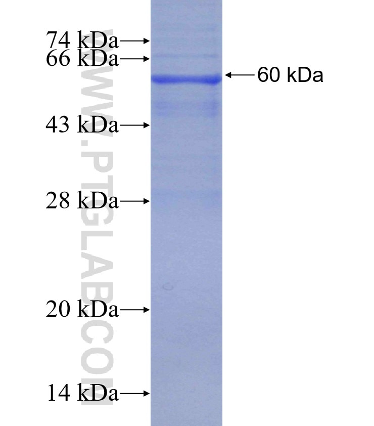 NUPL1 fusion protein Ag13901 SDS-PAGE