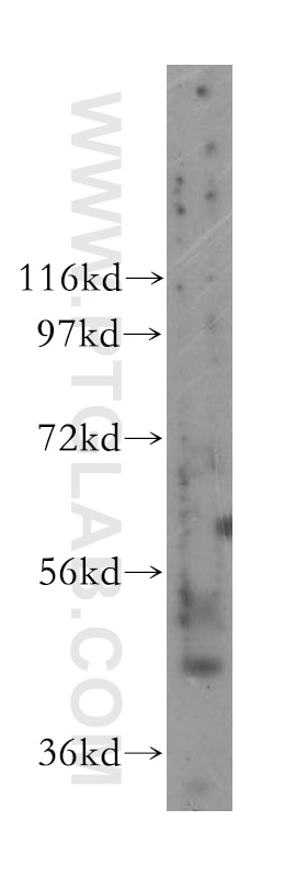 Western Blot (WB) analysis of human liver tissue using NUPL2 Polyclonal antibody (16587-1-AP)