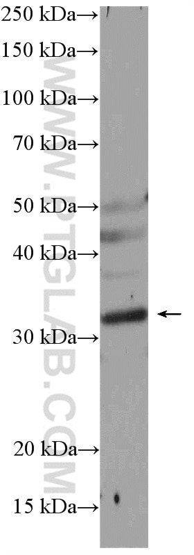 Western Blot (WB) analysis of mouse brain tissue using Nogo B receptor Polyclonal antibody (15986-1-AP)