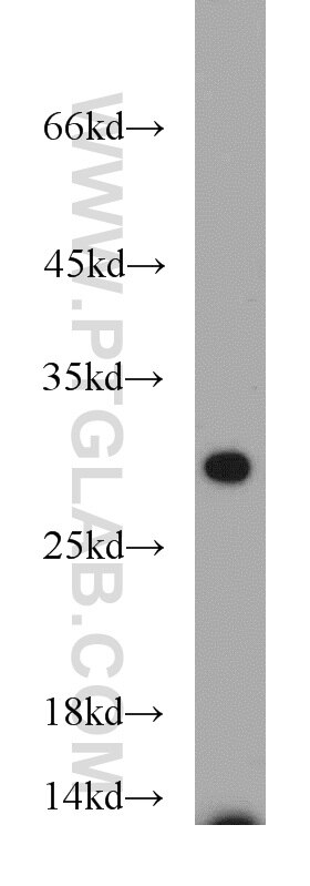 Western Blot (WB) analysis of mouse pancreas tissue using Nogo B receptor Polyclonal antibody (15986-1-AP)