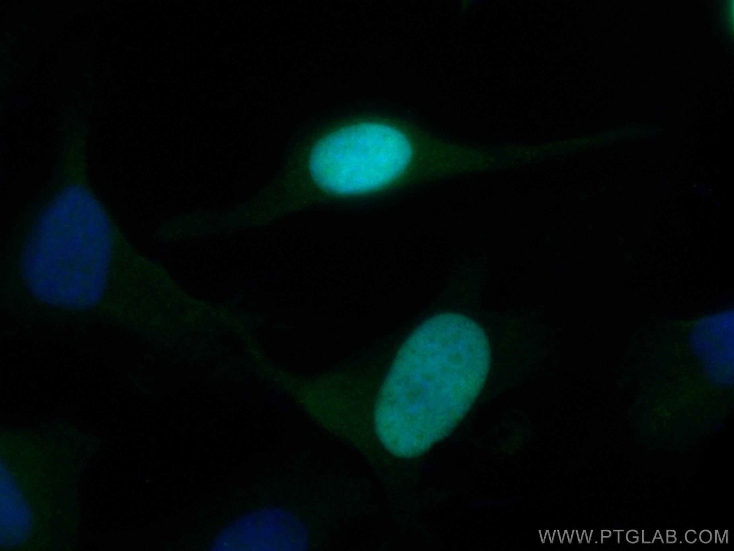 Immunofluorescence (IF) / fluorescent staining of HeLa cells using NUSAP1 Polyclonal antibody (12024-1-AP)