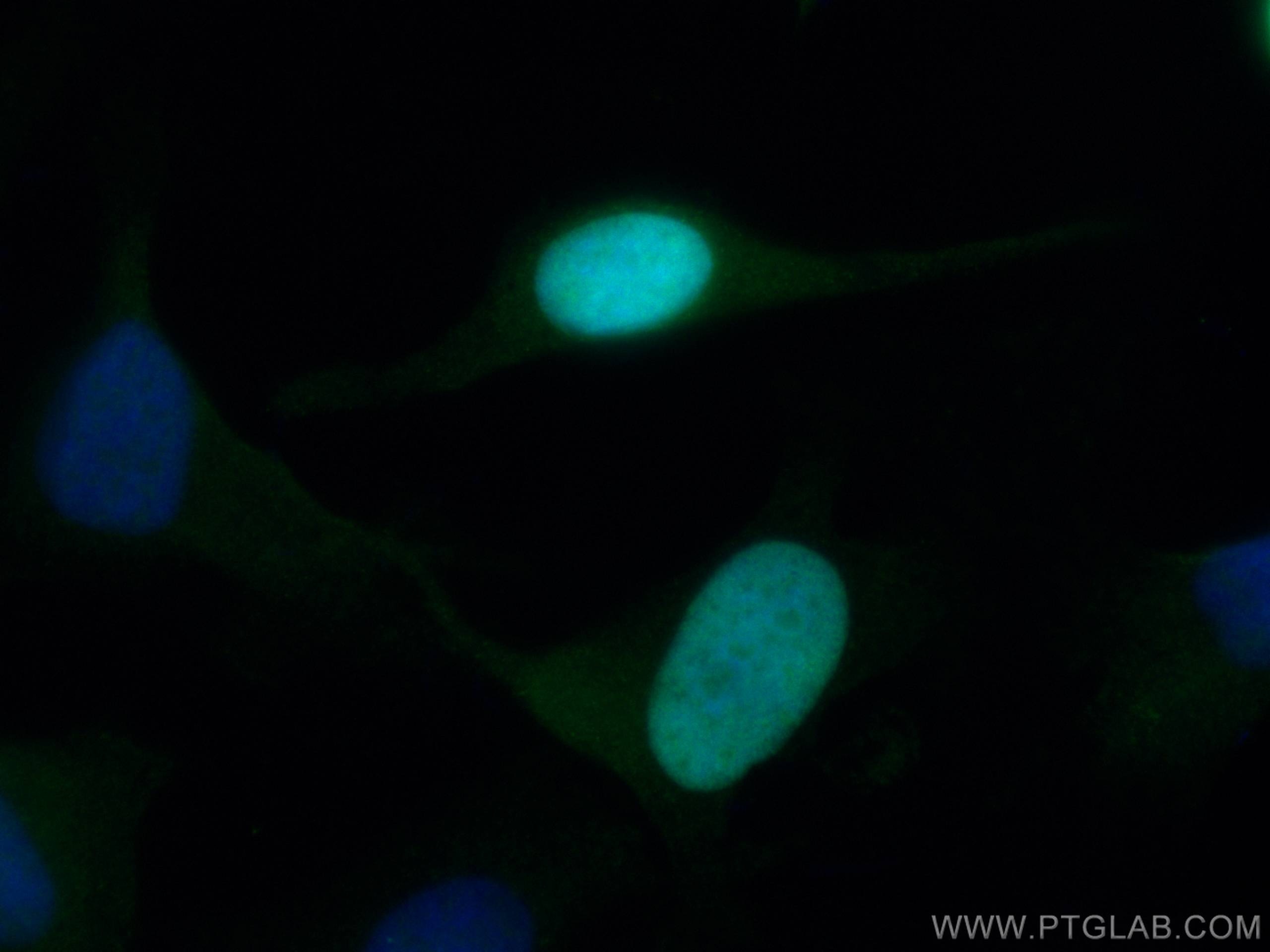 IF Staining of HeLa using 12024-1-AP