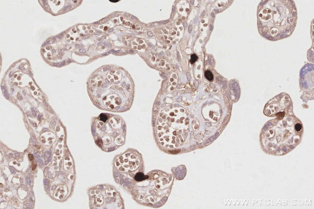 Immunohistochemistry (IHC) staining of human placenta tissue using NUSAP1 Polyclonal antibody (12024-1-AP)