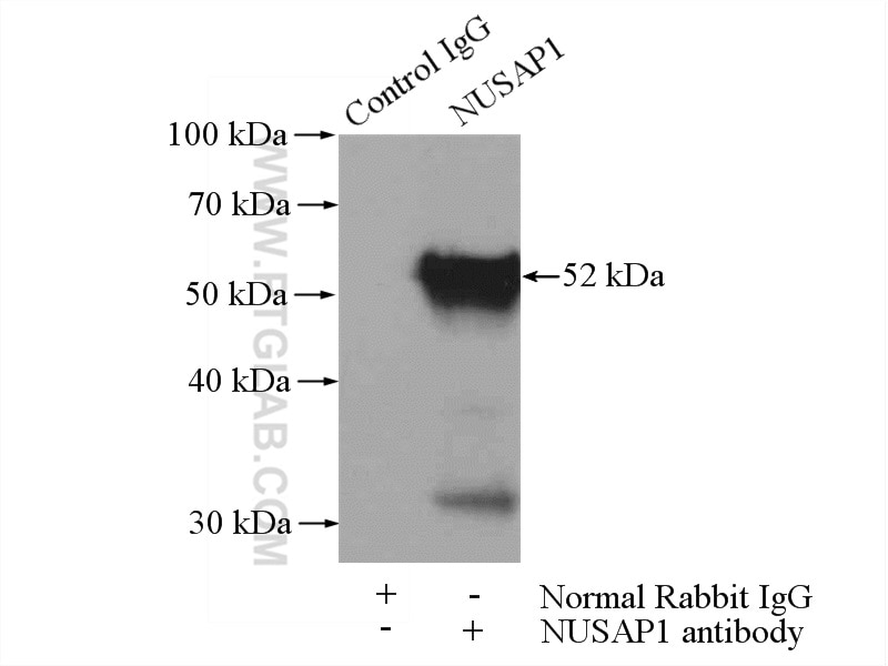 Immunoprecipitation (IP) experiment of HeLa cells using NUSAP1 Polyclonal antibody (12024-1-AP)