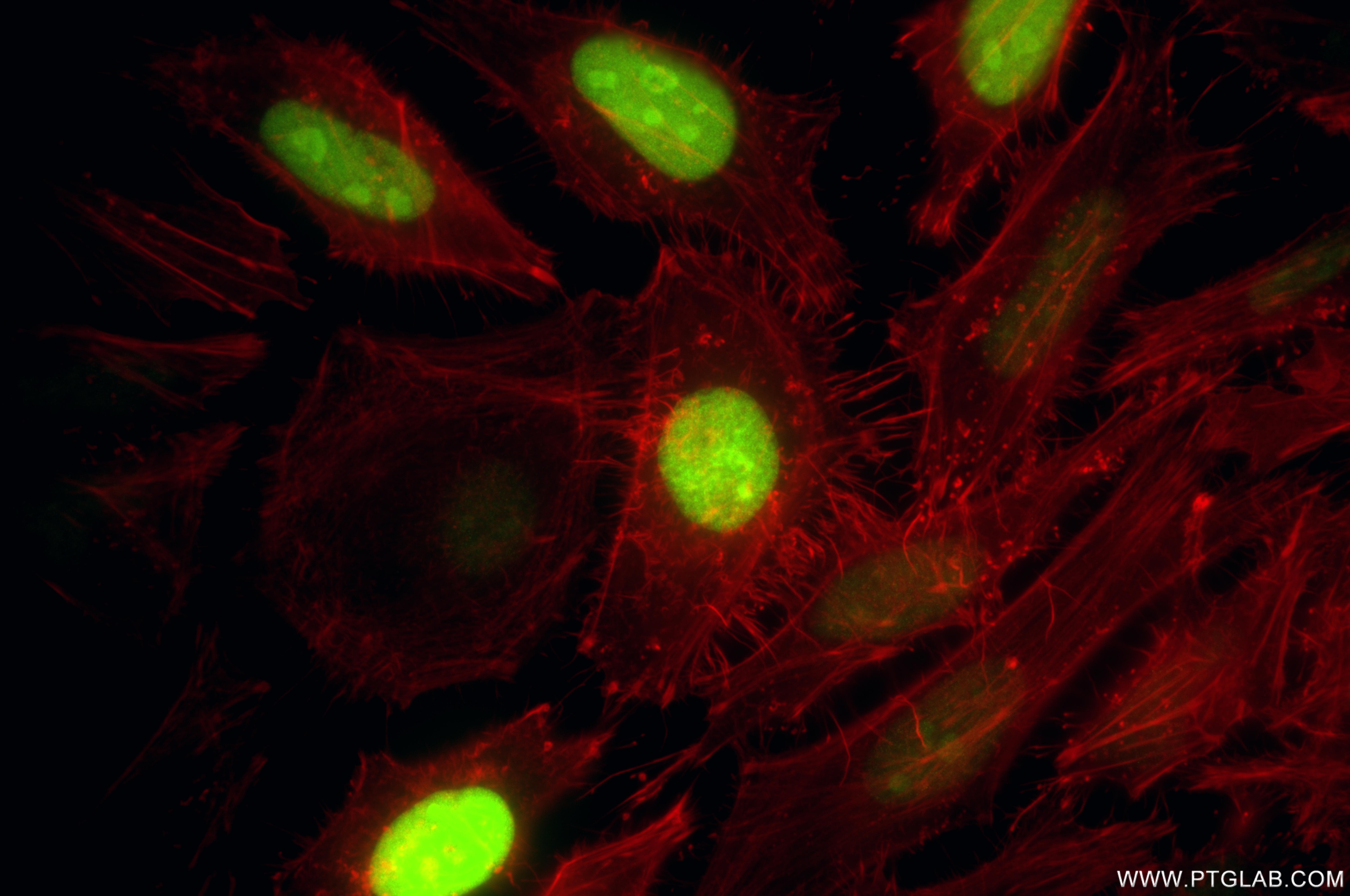 Immunofluorescence (IF) / fluorescent staining of HeLa cells using NUSAP1 Recombinant monoclonal antibody (87034-3-RR)