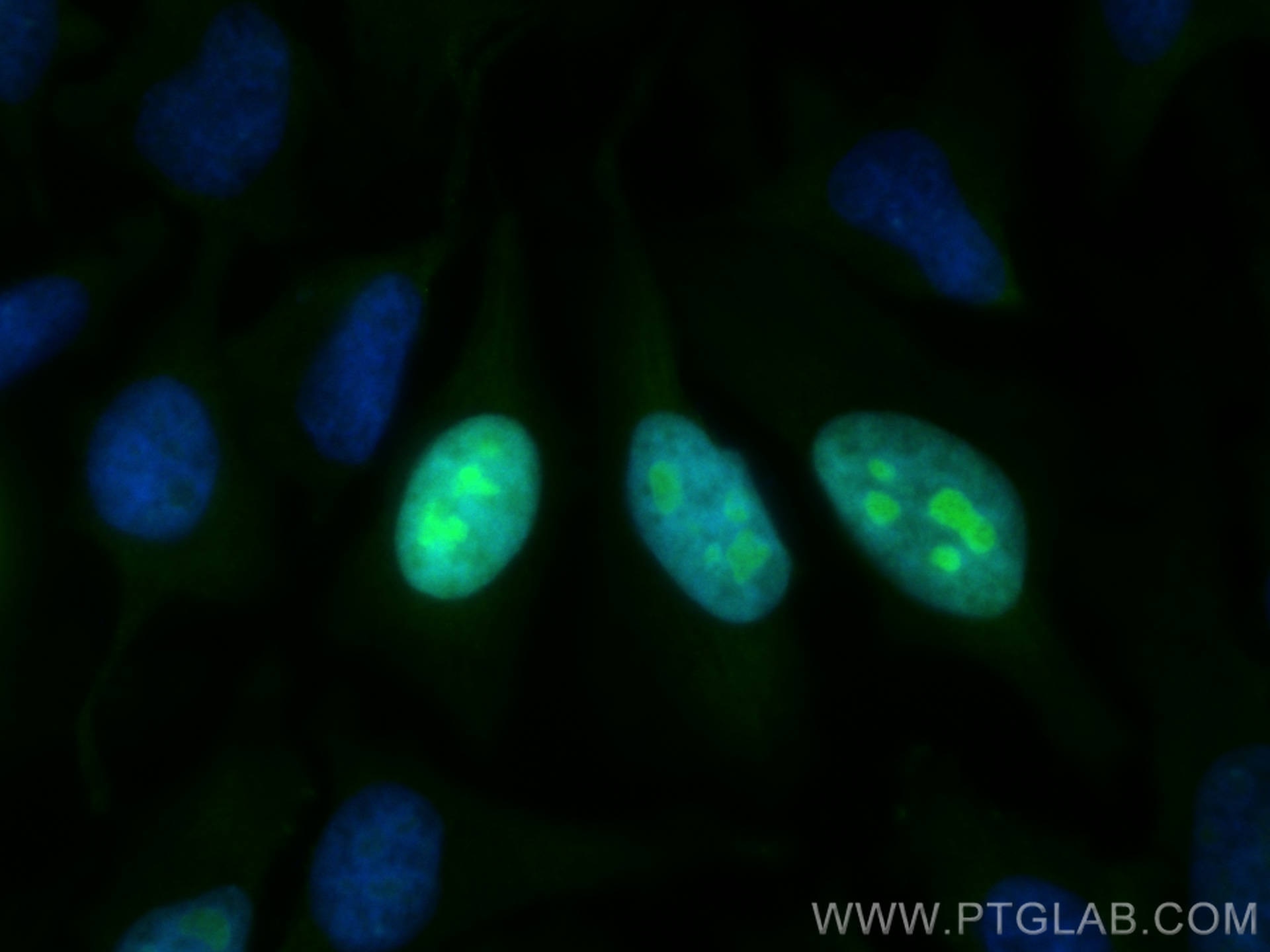 Immunofluorescence (IF) / fluorescent staining of HeLa cells using CoraLite® Plus 488-conjugated NUSAP1 Polyclonal an (CL488-12024)