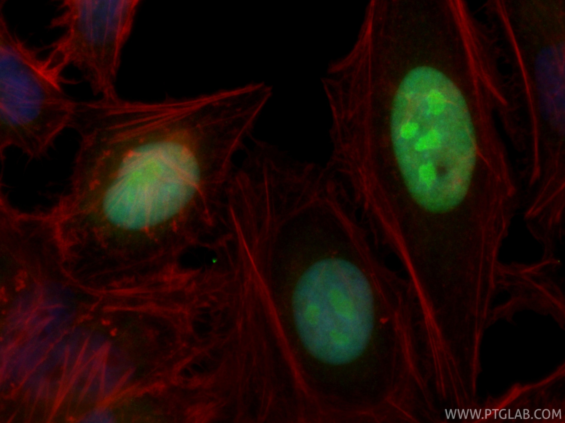 IF Staining of HeLa using CL488-87034-3 Immunofluorescence (IF) / fluorescent staining of HeLa cells using CoraLite® Plus 488-conjugated NUSAP1 Recombinant m (CL488-87034-3)