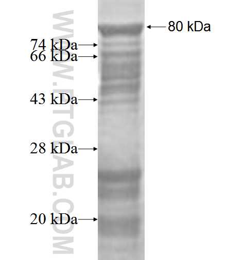 NUSAP1 fusion protein Ag2654 SDS-PAGE