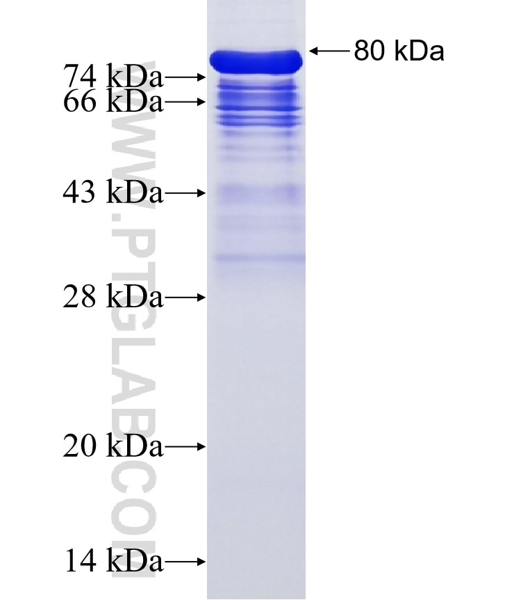 NUSAP1 fusion protein Ag2654 SDS-PAGE