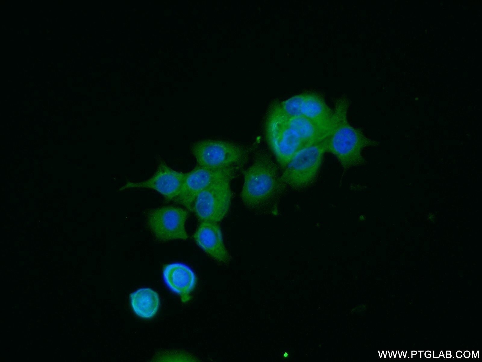 IF Staining of MCF-7 using 15538-1-AP