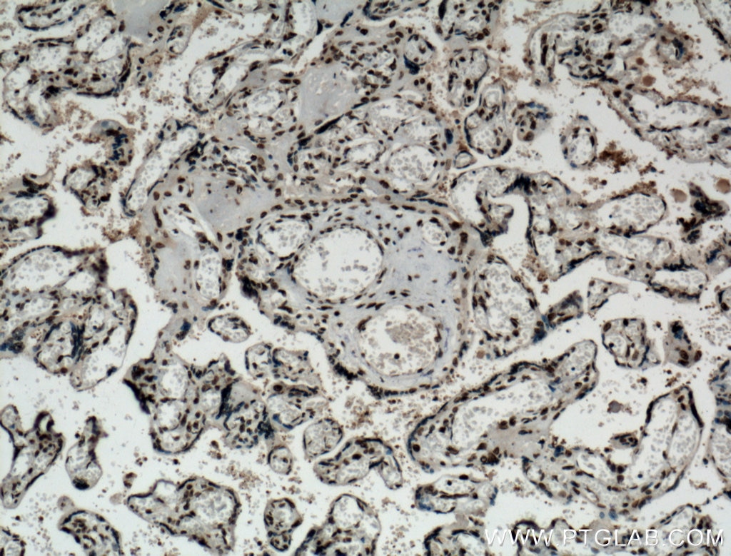 Immunohistochemistry (IHC) staining of human placenta tissue using NTF2 Monoclonal antibody (66063-1-Ig)