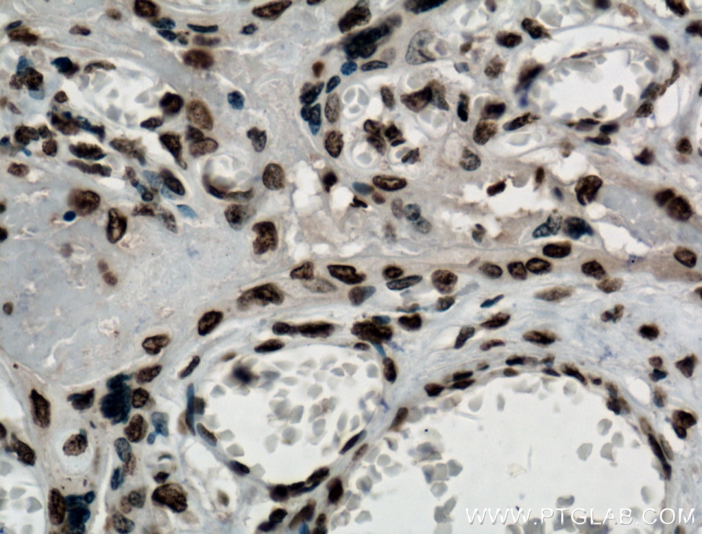 IHC staining of human placenta using 66063-1-Ig