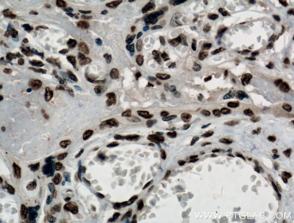 Immunohistochemistry (IHC) staining of human placenta tissue using NTF2 Monoclonal antibody (66063-1-Ig)