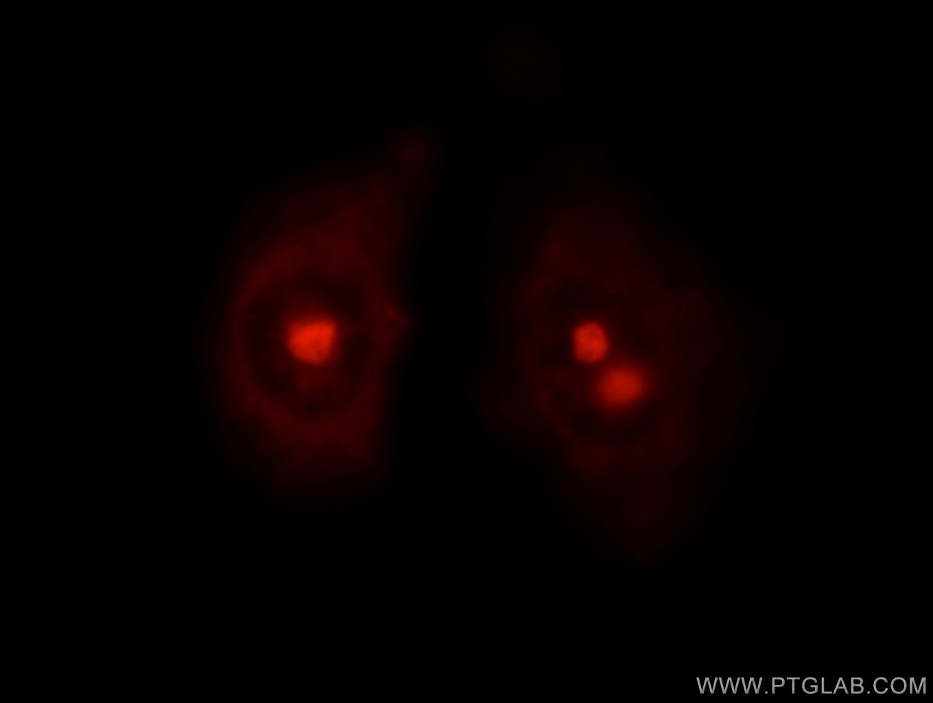 Immunofluorescence (IF) / fluorescent staining of HepG2 cells using NVL Polyclonal antibody (16970-1-AP)